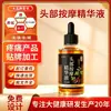 Solución Calmante para el Cuero Cabelludo y Anti-Caída del Cabello Personalizada OEM para Salones de Belleza y Centros de Bienestar, Esencia Nutritiva para Masaje Capilar