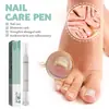 Pluma para el Cuidado de las Uñas, Solución Limpiadora y Aclaradora para el Cuidado de Uñas Dañadas, Tipo Engrosador, Pluma Diaria para el Cuidado de Uñas Dañadas