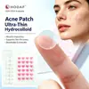 Parche para Acné KuangJie Parche Hidrogel Invisible para Acné Calificación CE OEM Personalizado Parche para Acné Microcristalino
