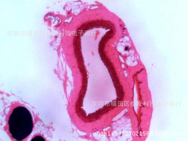 动脉纵切