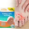 Crazylife patch transfronteiriço para cuidados com as unhas incrustação sulco da unha carne embutida patch ortopédico unha macia unha cinza patch de reparo de unha