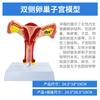 Modelo de útero femenino médico modelo de estructura reproductiva ovárica modelo de anatomía ginecológica Obstetricia y Ginecología modelo de ovario y útero