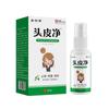 Limpiador de Cuero Cabelludo Xinbaitai al por Mayor para Fabricantes 30ml Reemplazo de Cabello
