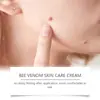 Crema para el Cuidado de la Piel con Veneno de Abeja Hoygi Limpieza Suave, Hidratante y Suavizante Crema para el Cuidado de la Piel para la Piel con Molestias