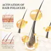 Aceite Esencial de Romero y Aceite de Ricino para el Cuidado del Cabello de Venta Caliente Transfronteriza, Serum de Aceite de Ricino Nutritivo para el Cuero Cabelludo y Espesante del Cabello