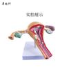 Modelo patológico uterino femenino estructura uterina ovárica materna y reproductiva Anatomía simulación avanzada modelo uterino mórbido