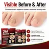 Sumifun parche para el cuidado de uñas en casa transfronterizo set mixto, combinación de parches para uñas multiestilo k900036