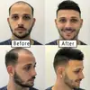 Peluca para Hombre para la Parte Superior de la Cabeza, Fibra de Alta Temperatura, Invisible, Sin Costuras, para Calvicie, Línea de Cabello Mediterránea, para Cubrir Canas, Peluca
