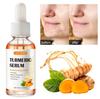 Aceite Esencial de Cúrcuma Sefudun Masaje Corporal Hidratante Facial Unisex 30ml