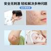 Agua Salina de Cloruro de Sodio Gemeiyan 0.9 Compresa Húmeda Facial de Belleza para Tatuajes y Bordado de Cejas Botella Pequeña de 100ml Cuidado Facial Hidratante
