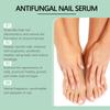 Esencia para el Cuidado de Uñas South Moon Limpieza Suave Cuidado de Uñas de Manos y Pies Esencia para Cuidado de Uñas Gruesas de los Pies
