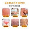 Crema Antibacteriana para la Piel Xianhuaitang, Crema para la Picazón Húmeda, Ampollas por Picaduras de Mosquitos, Erupción, Crema Anti-Picazón Baicao, Crema para el Cuidado de la Piel