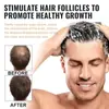 Eelhoe Champú para el Cabello Cuidado Diario para Cabello Esponjoso Cuidado Suave Champú para el Cuidado del Cabello