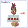 Pnt-0724 Modelo de Corazón 4 Etapas Vaso Sanguíneo Patología Arterial Anatomía Cardíaca Cardiovascular Pantalla Materiales Didácticos