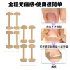 Herramienta de Corrección de Uñas, Cuidado de los Pies, Parche para Uñas del Pie, Herramienta de Corrección de Uñas Encarnadas, Corrección de Surcos de Uñas