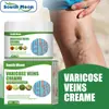 Crema Suavizante para Piernas South Moon, Amigable con la Piel, Suave, Hidratante y Rejuvenecedora, Crema de Masaje para el Cuidado de las Piernas