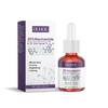 OUHOE Esencia purificadora y compacta para el acné con nicotinamida, esencia hidratante suave para el rostro y el cuerpo.