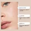 Parches para el Acné para el Cuidado de la Piel, Limpieza Suave de los Poros con Acné Facial, Ocultamiento, Invisibles, Parches para el Acné Amigables con la Piel