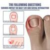 Ficha de Datos de Seguridad Aceite Popular para el Cuidado de las Uñas de Manos y Pies, Uñas Encarnadas, Hidratante Suave para Uñas, Fabricante de Uñas Venta al por Mayor Transfronteriza