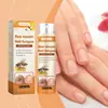 Spray de Cuidado para Unhas HouKea Limpeza de Unhas dos Pés Spray Hidratante para Cuidado das Unhas