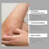 Crema para el Cuidado Corporal Houkea Alivia el Malestar de la Piel del Cuerpo Ingredientes Herbales Cuidado Suave Uso Externo Crema Nutritiva