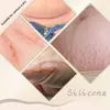 Bálsamo de Silicona para Cicatrices Bálsamo de Silicona para el Cuidado de Cicatrices Bálsamo de Silicona para Cicatrices para Reparación de Estrías