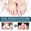 Solução para Cuidado de Unhas Ximonth para Unhas Encravadas e Espessadas, Solução para Cuidado de Unhas das Mãos e Pés