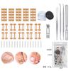 Corrector de inserción de uñas Amazon Nail Groove, hebilla para uñas, bobina para uñas, alicates para corrección de uñas, juego de parches para uñas