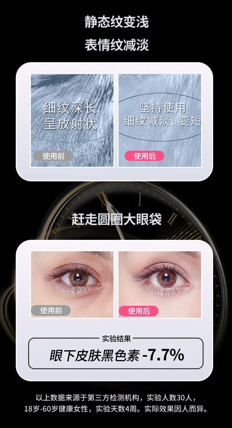 S2309R-眼部射频仪详情页_07.jpg