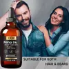 Tinta de Minoxidil 5% Solução Original Cuidado do Couro Cabeludo Crescimento Capilar Biotina Essência para Cuidado Capilar Crescimento Capilar Certificado SGS