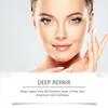 Esencia Hidratante OUHOE para la Piel Facial Hidratante e Hidratante Nutritiva Suave e Hidratante Profunda Reafirma la Piel