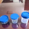 O Copo para Coleta de Escarro Médico Kehua é Resistente a Altas Temperaturas e Alta Pressão, Não Deforma, e a Capacidade do Corpo do Copo é Claramente Marcada e Fácil de Ler e Escrever