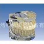 3岁标准乳牙模型医学模型