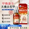 Fabricante Yingchunhan Onicomicosis Venta al por Mayor Engrosamiento de Uñas de Manos y Pies Uña Suave Iluminador Líquido para Onicomicosis Solución de Cuidado para Uñas