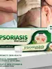Comercio exterior transfronterizo Amazon AliExpress crema antibacteriana de hierbas a musgo para el cuidado de la piel antipruriginosa