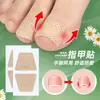 Parche Gris Suave para Reparación de Uñas Parche para el Cuidado de las Uñas Uña Encarnada Pliegue de la Uña Almohadilla para Dedo del Pie Almohadilla Ortopédica Parche para Estirar la Uña del Pie