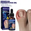 Aceite para el Cuidado de las Uñas West&Month Mano, Pie Uñas Encarnadas, Uñas Suaves, Hidratante de Uñas, Aceite de Cuidado Diario