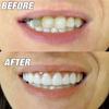 Juguete transfronterizo para blanquear la dentadura, funda para blanquear la dentadura, pegatina dental de silicona, simulación de aparatos dentales OPP