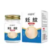 Creme para Saúde de Estrias, Marcas de Obesidade Pós-Parto, Creme para Massagem de Marcas de Crescimento, Creme para Aplicação Externa na Pele, Estoque Pronto para Atacado do Fabricante