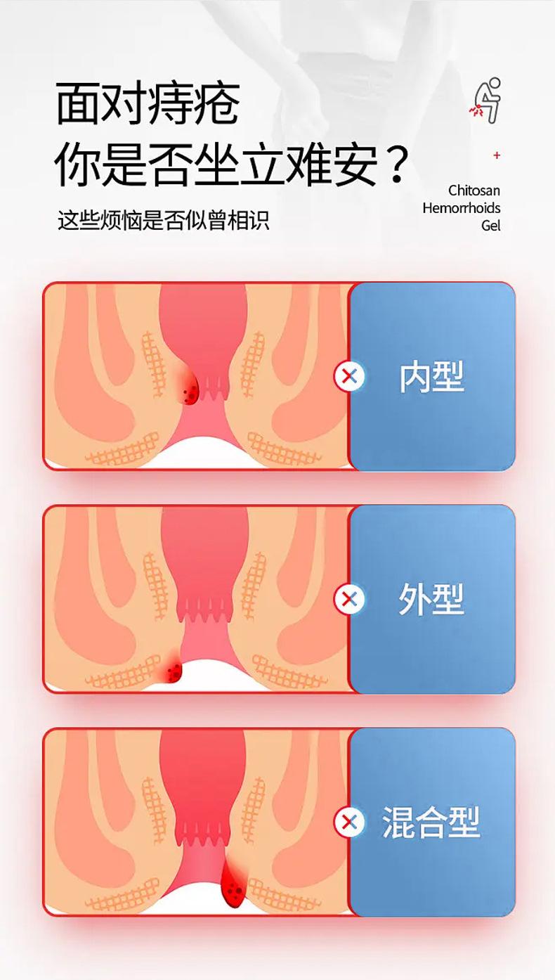 痔疮膏