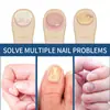Parche para el Cuidado de las Uñas de los Pies Eelhoe con Ingredientes Suaves que Protegen la Superficie de la Uña, Dejándola Suave, Brillante, Transpirable y Amigable con la Piel