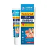 Crema para Onicomicosis Pomada Suave para Eliminar Uñas con Onicomicosis Venta Directa de Fábrica Soporta Dropshipping