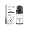 OUHOE Solución para el Cuidado de las Uñas Cuidado suave de las uñas, limpieza, brillo, suavidad, protección, tersura, frescura, comodidad, líquido de mantenimiento