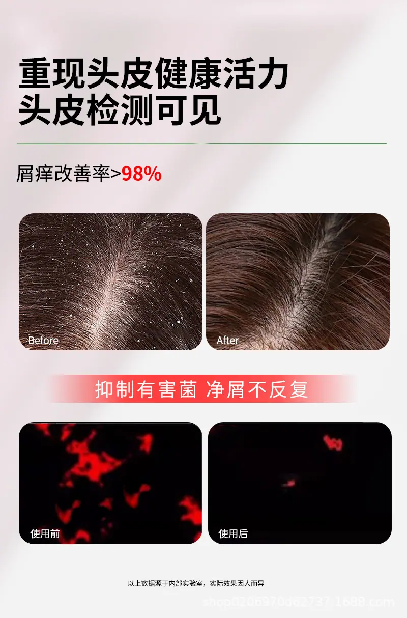 1去屑舒爽洗发露_05.jpg