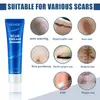 Crema para el Cuidado de la Piel EELHOE Cuidado suave para uso externo en el cuerpo, hidrata y suaviza la piel, crema de aplicación diaria