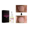 Aceite Transfronterizo para Cutícula de Uñas, Aceite para el Borde de la Uña, Aceite Nutritivo para Uñas Aceite para la Capa de Queratina de la Uña