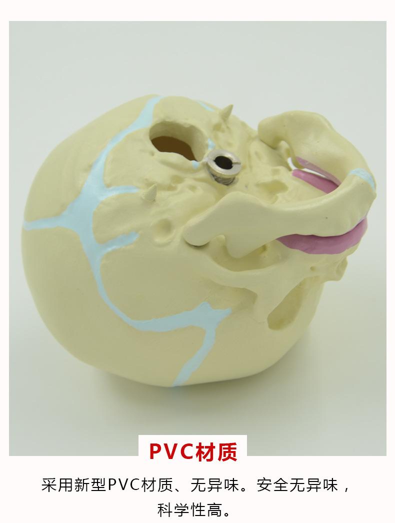 婴儿头骨模型