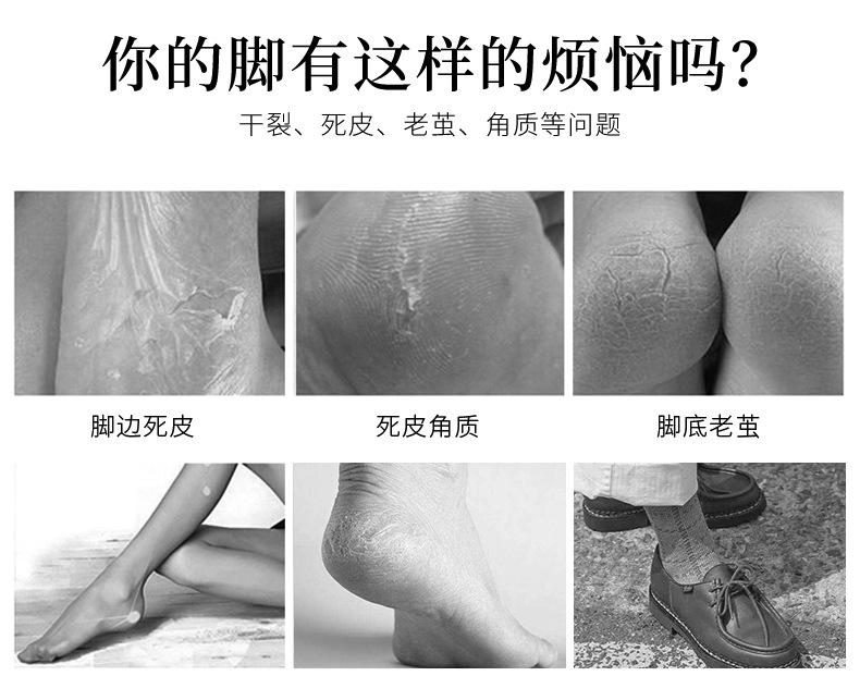 详情_02
