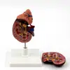 Modelo de Riñón con Demostración de Páncreas Instrumento Biológico Hospital Investigación Humana Escuela Materiales Didácticos para Estudiantes Personalización