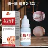 Crema Youdao para Uñas de Manos y Pies Cuidado de la Salud Líquido Extracto de Hierbas Douyin Kuaishou Transmisión en Vivo Comercio Electrónico Suministro Una Pieza Envío Directo